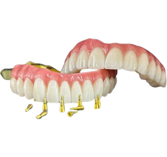 All-on-X Zirconia