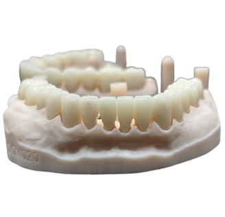 Emax Crown
