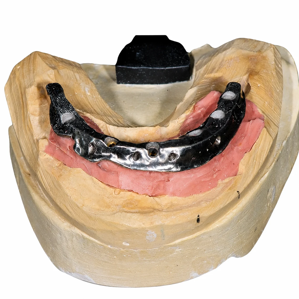 Hybrid Implant