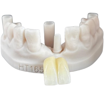 Screw Retained