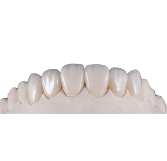 Veneer