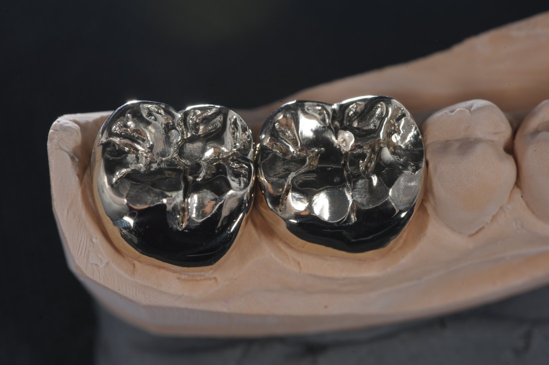 Full Metal Crown