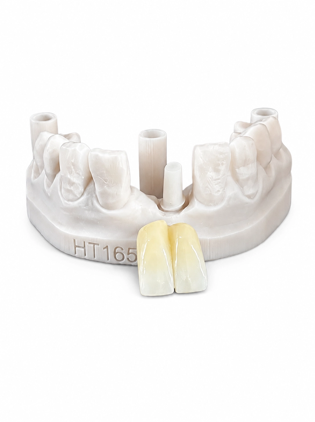 Screw Retained