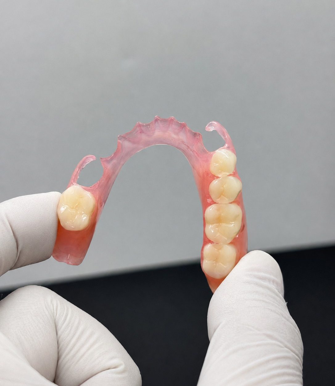 Partial Denture