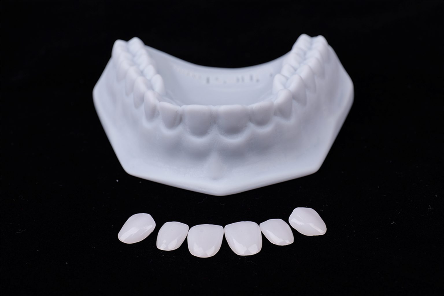 Full glass ceramic veneer inlay onlay
