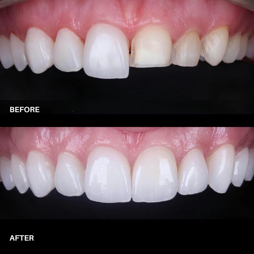 OEM & ODM Dental Lab Solutions